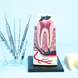 Model of a decayed tooth