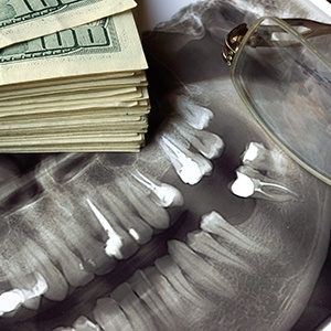 Money on a dental x-ray